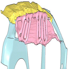 [ side curtain deployment ]